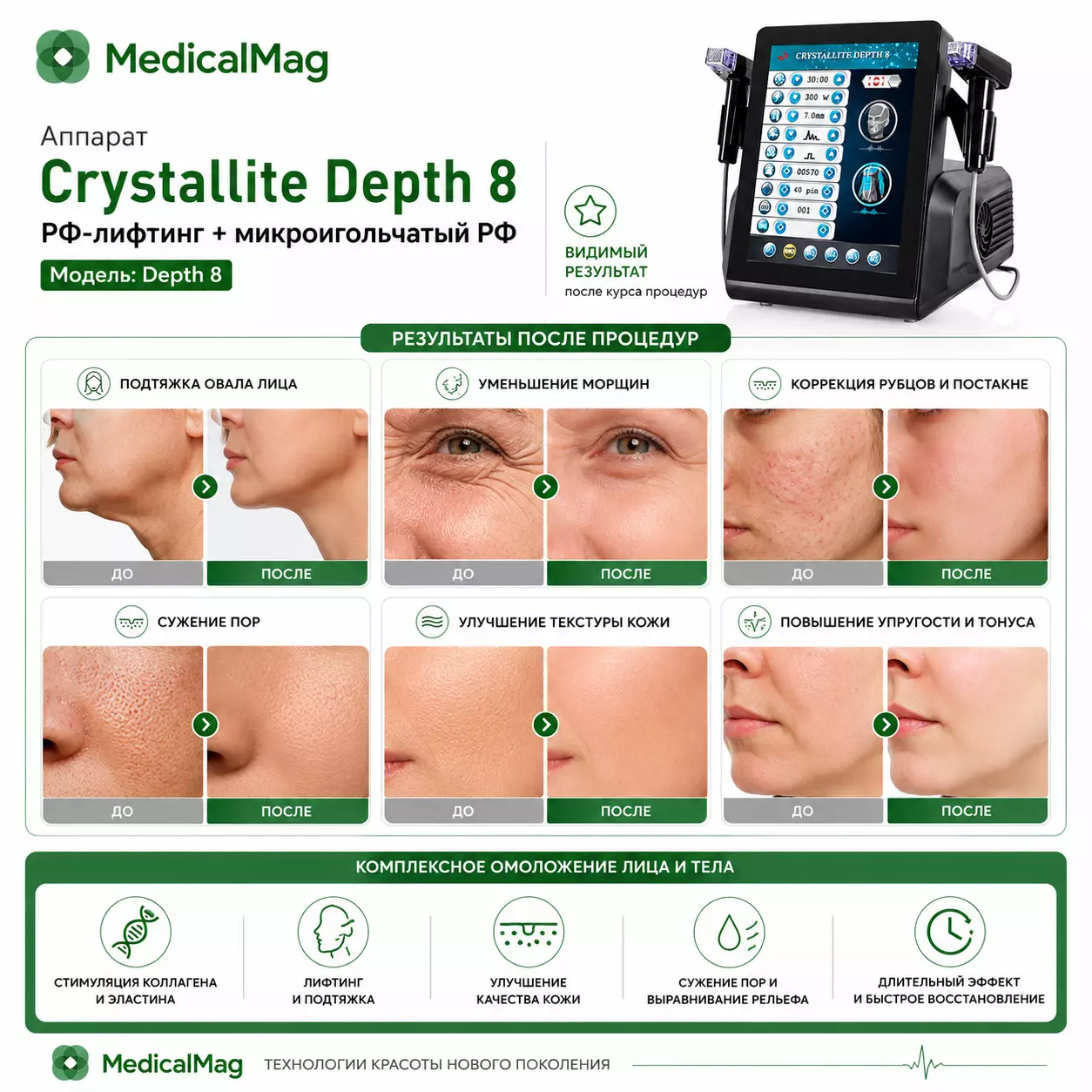 Аппарат Crystallite Depth 8 РФ-лифтинг + микроигольчатый РФ Модель: Depth 8