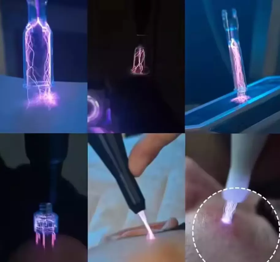Косметологический аппарат холодной плазмы Fusion Plasma Mini (Cool Plasma mini)