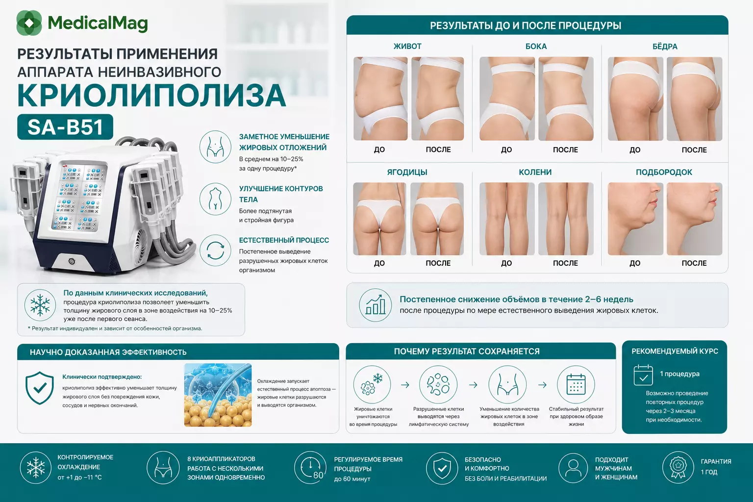 Аппарат неинвазивного криолиполиза SA-B51