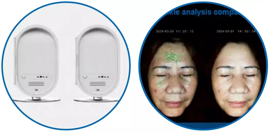 Анализатор кожи MBT SKIN ANALYZER