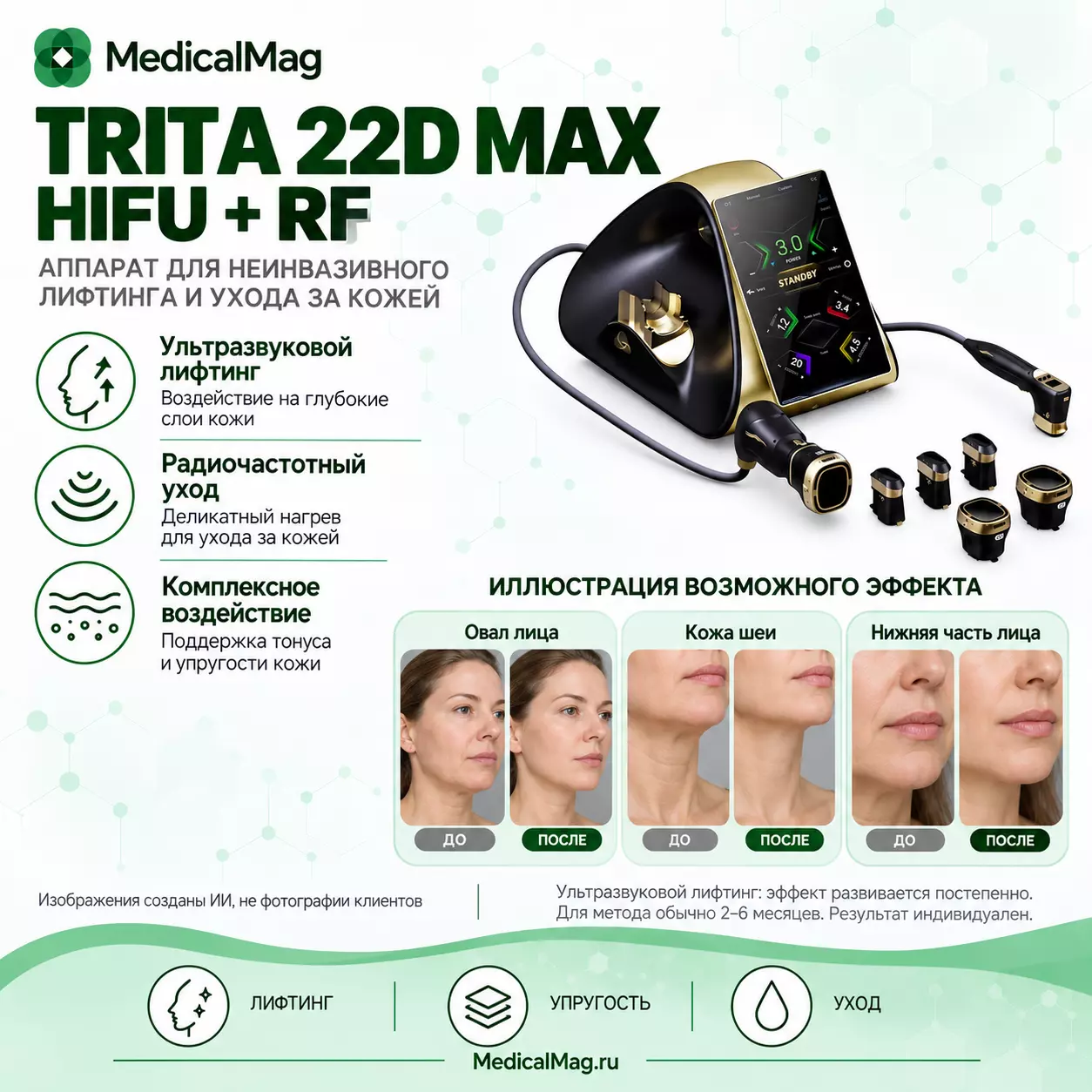 Аппарат SMAS омоложения и коррекции фигуры HIFU TRITA 22D MAX