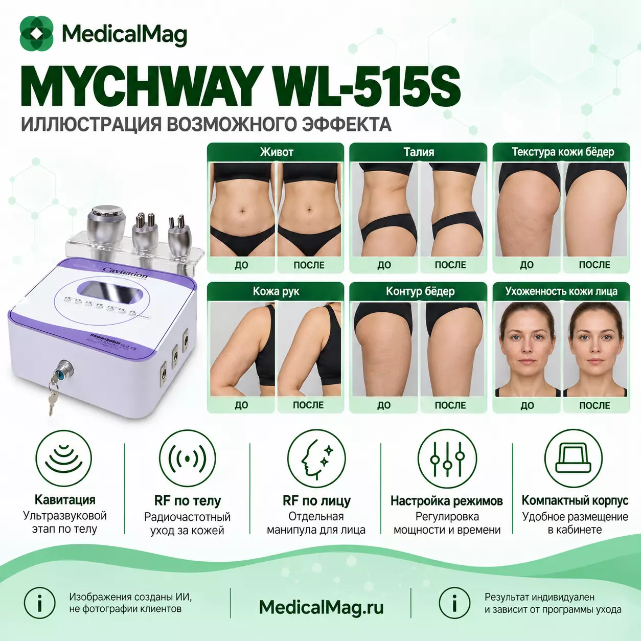 Аппарат кавитации с RF лифтингом WL-515S