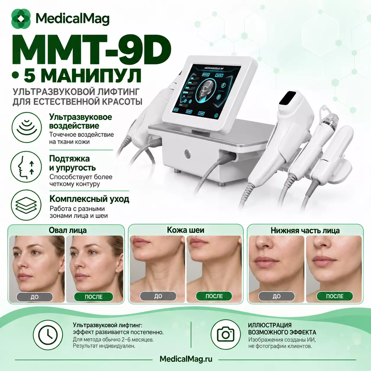 Аппарат СМАС лифтинга + RF + Интимное MMT-9D (5 манипул)