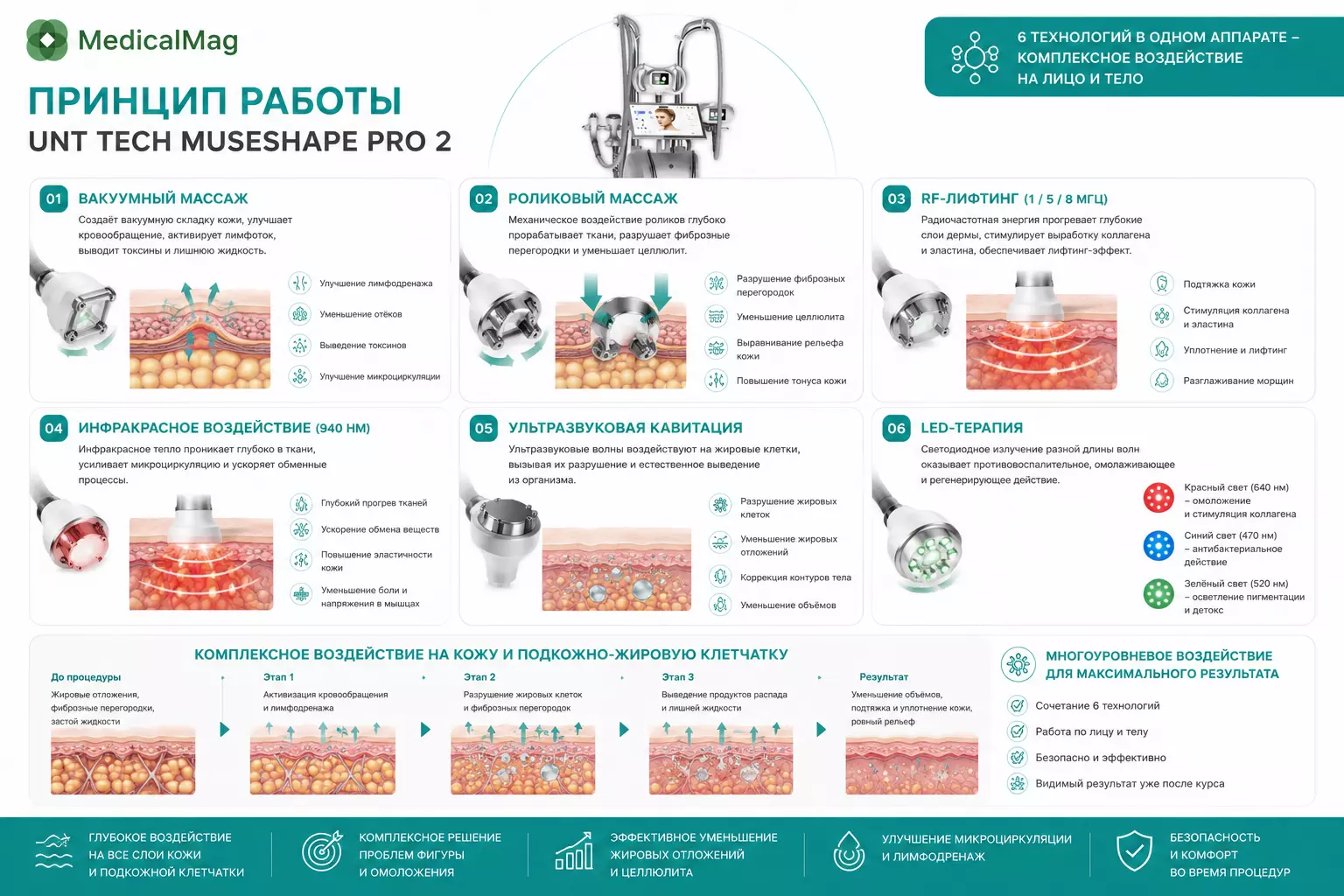 Аппарат вакуумно-роликового массажа UNT Tech MuseShape PRO 2