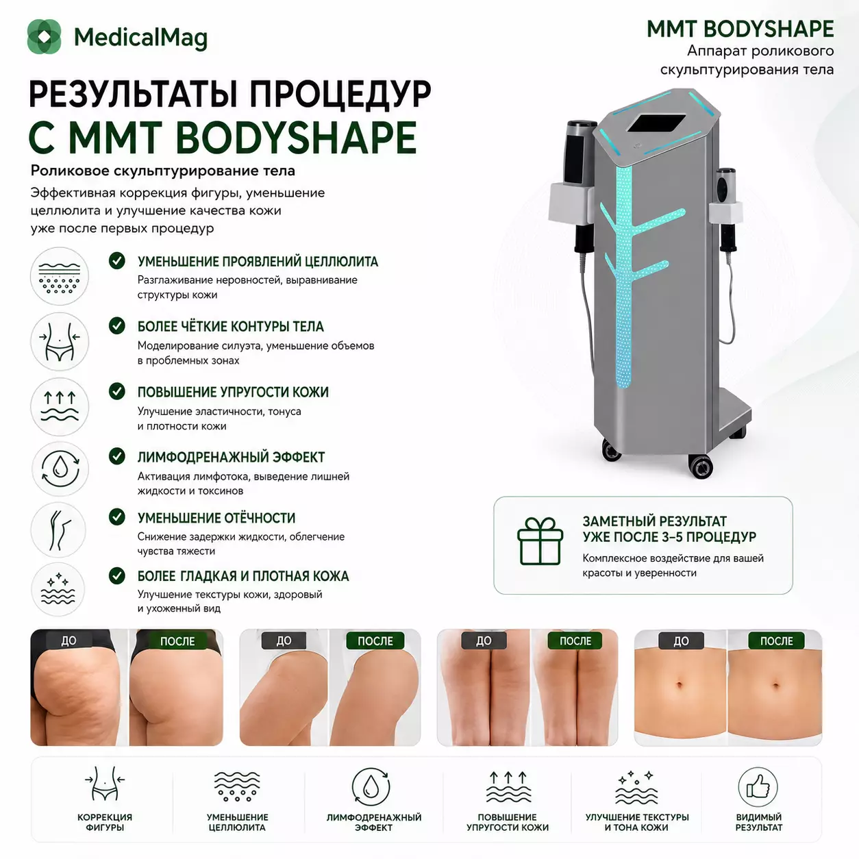 Аппарат роликового скульптурирования тела MMT BodyShape