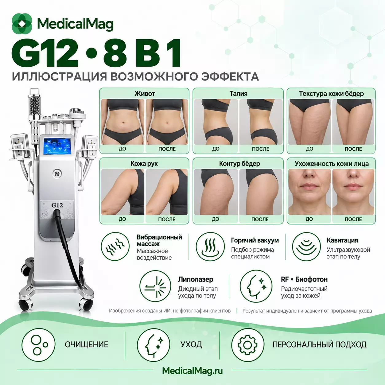 Аппарат 8 в 1 G12: вибрационный массаж + горячий вакуум + биофотон+ кавитация + липолазер + RF-лифтинг + вакуумно-баночный массаж + роликовый массаж