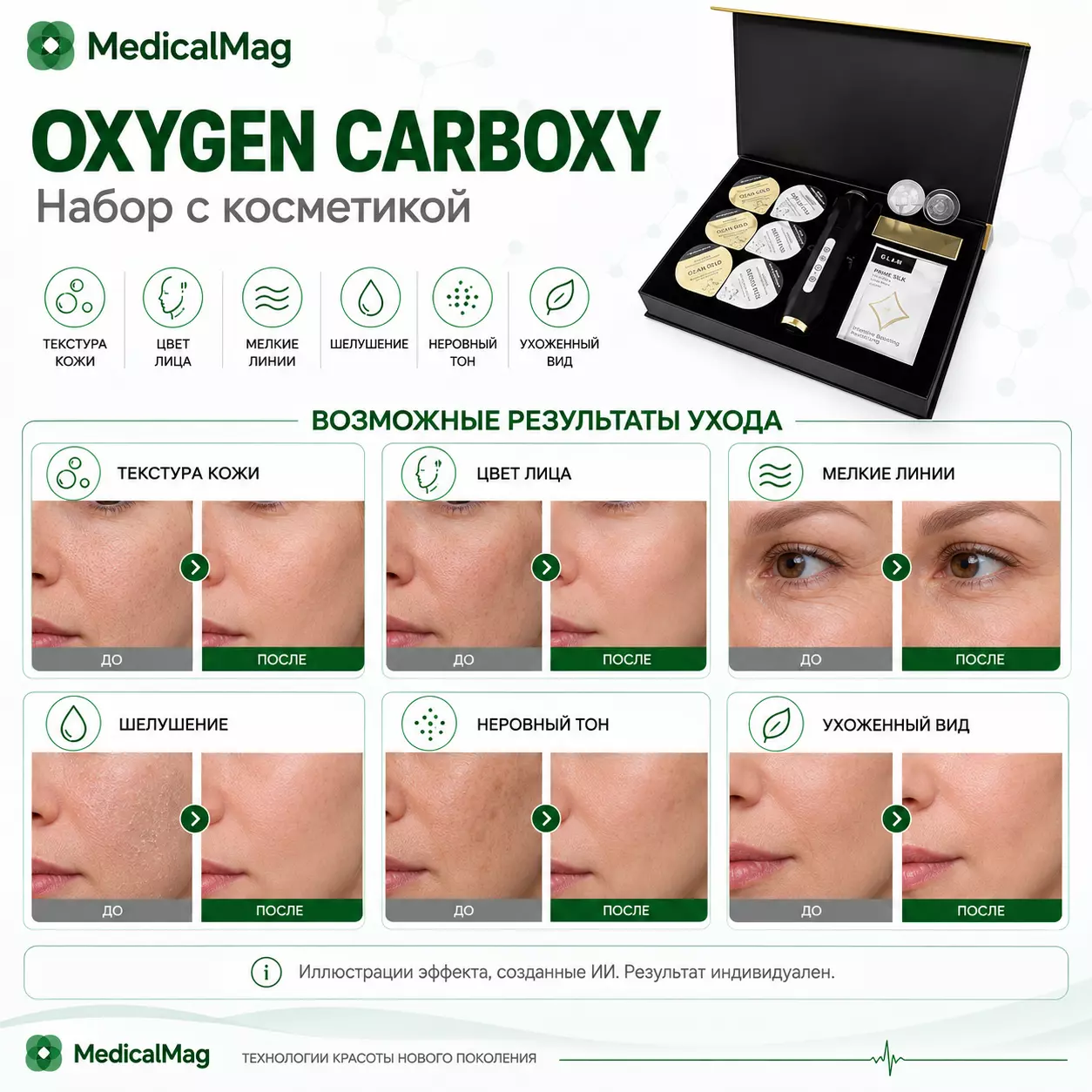 Аппарат карбокситерапии OXYGEN Carboxy портативный (набор с косметикой)