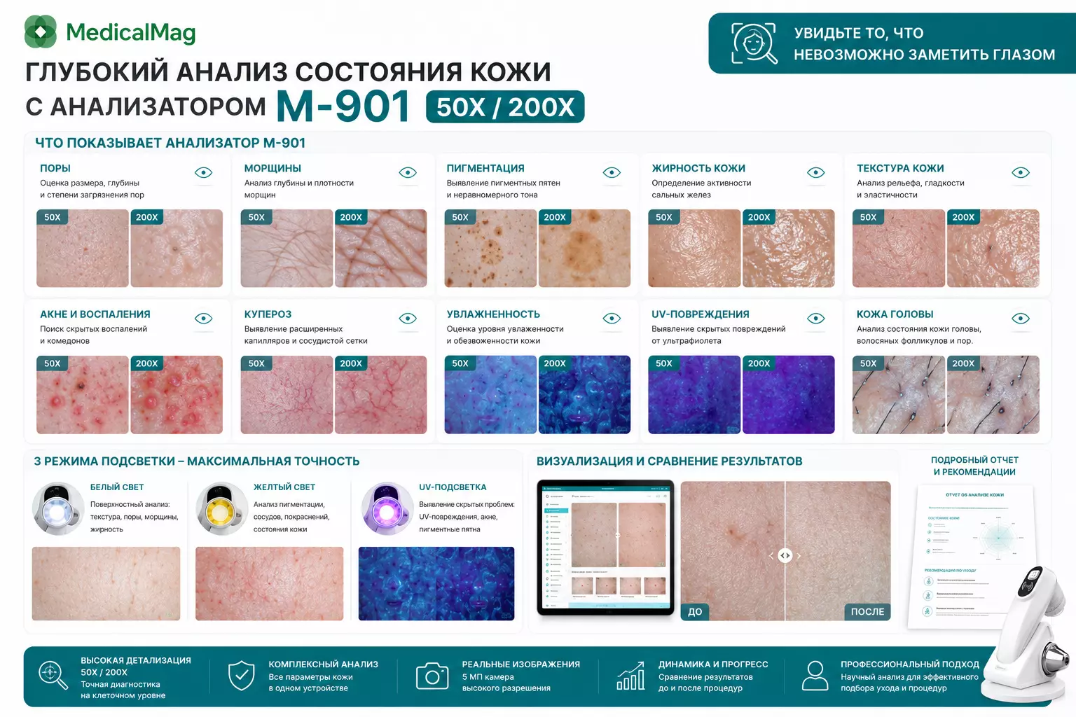 Анализатор кожи лица IM-901  50X/200X