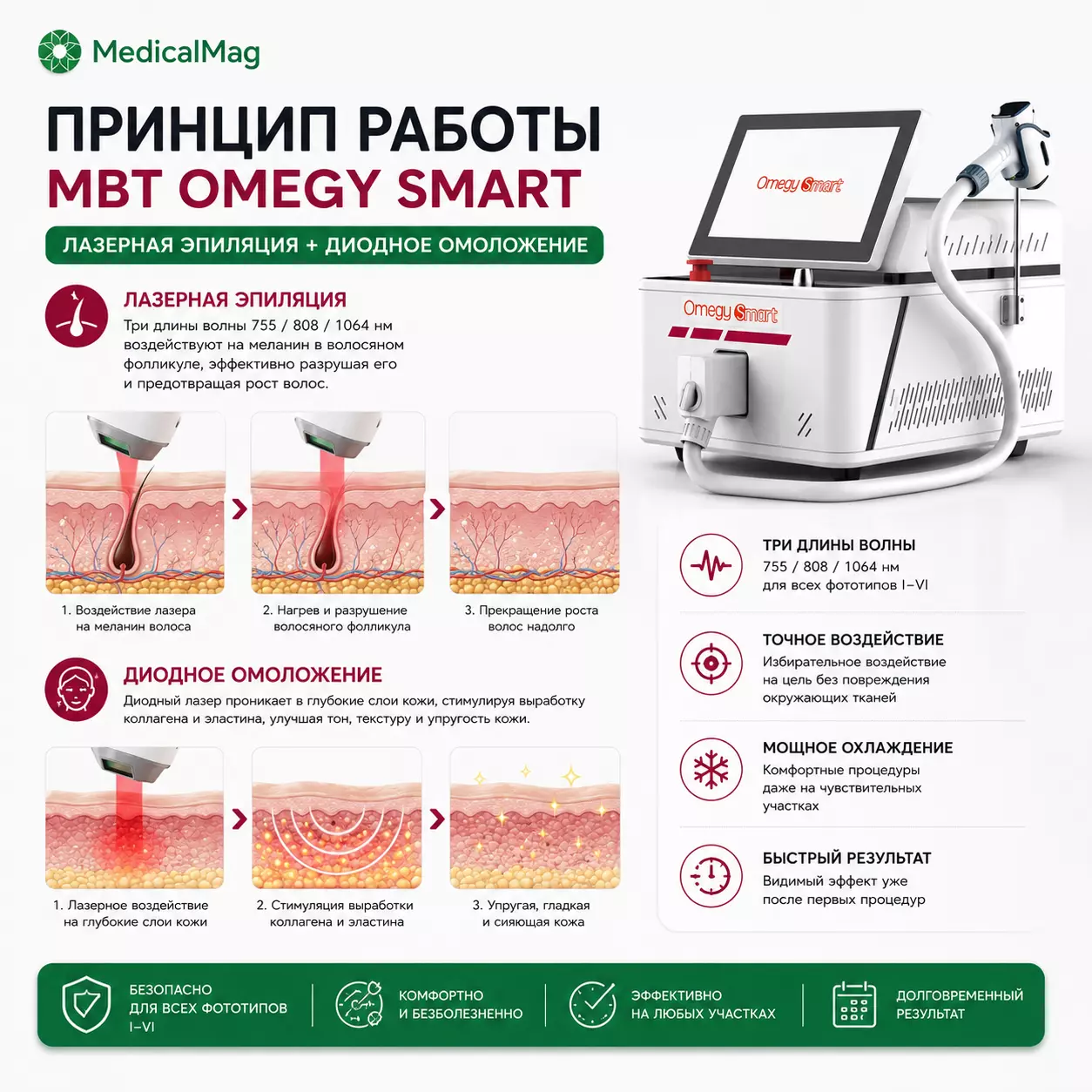 Аппарат для лазерной эпиляции и диодного омоложения MBT OMEGY SMART