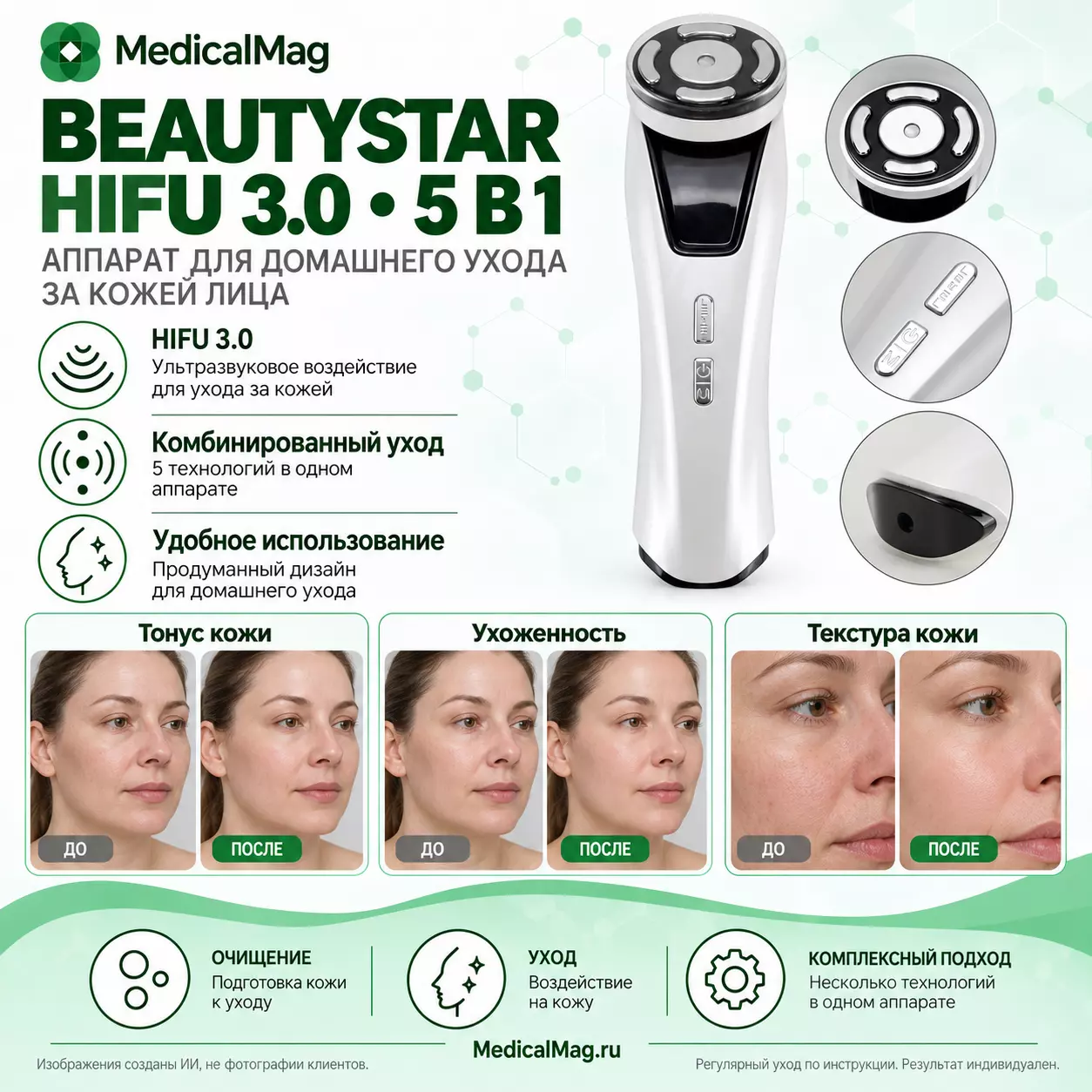 Массажер для лица 5в1 BeautyStar HIFU 3.0 (HIFU, RF, EMS, LED, УЗ) Белый