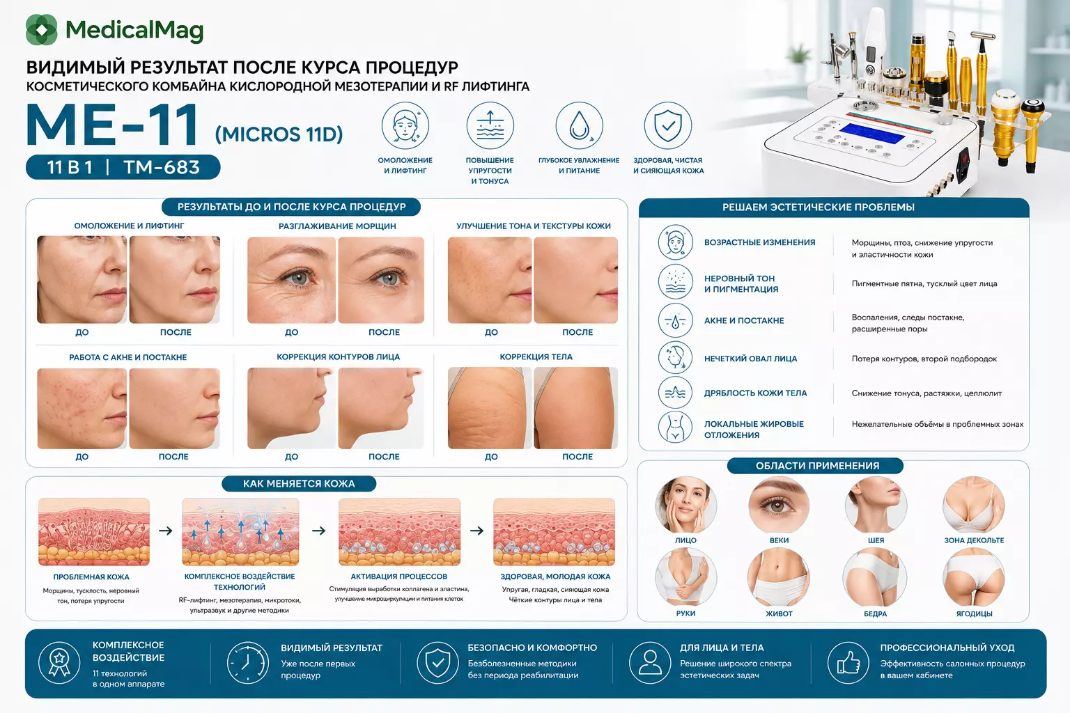 Косметический комбайн кислородной мезотерапии и RF лифтинга 11 в 1 МЕ-11 (MICROS 11D) TM-683