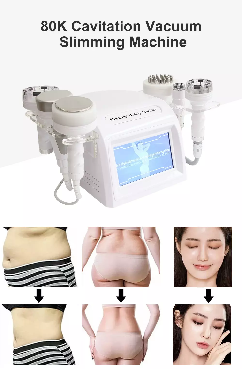 Косметический аппарат Beauty Star STEREOSLIM 5D 6в1 (вакуум, кавитация, РФ-лифтинг, биофотон, вибромассаж)
