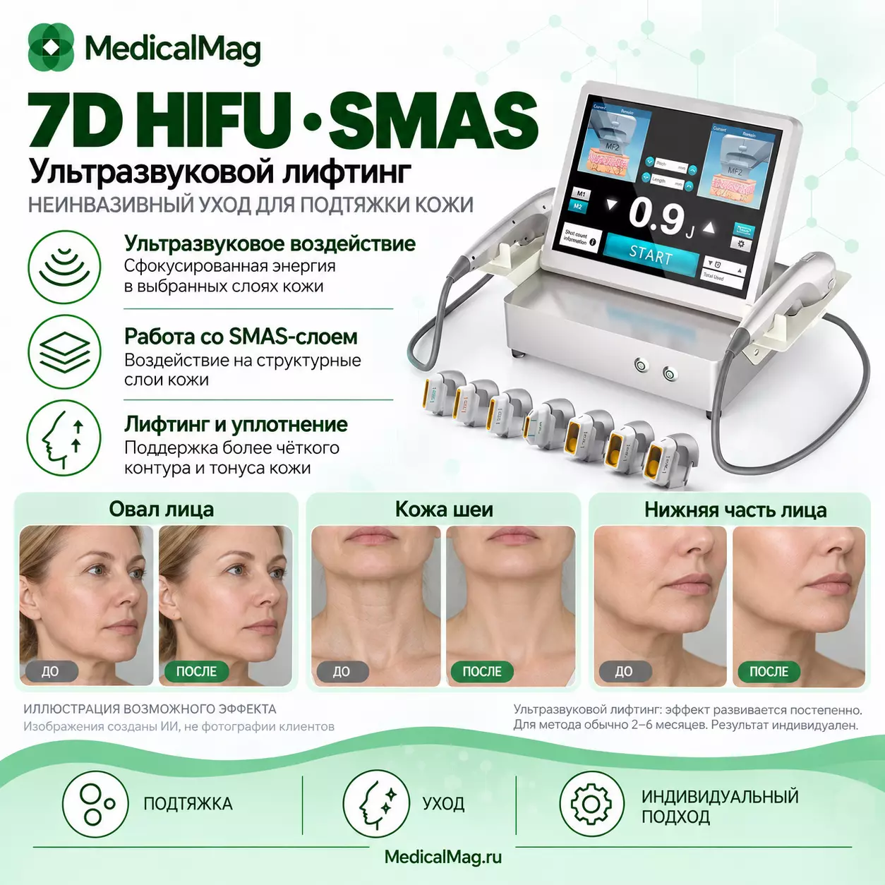 Аппарат подтяжки лица и липолиза тела 7D HIFU SMAS