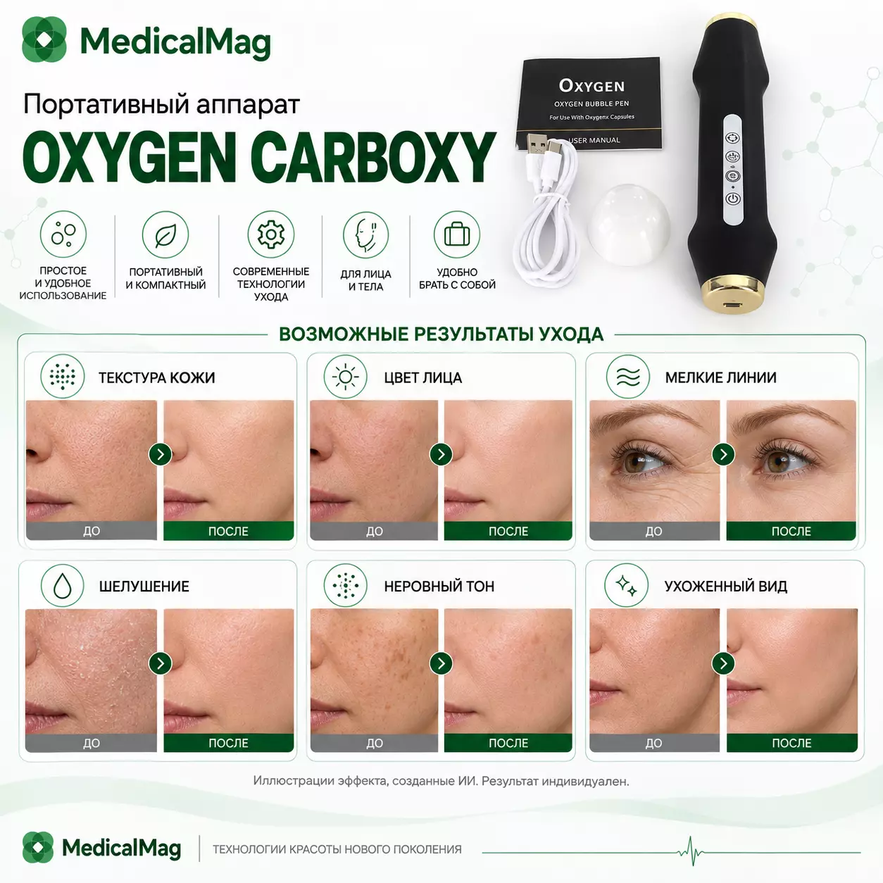 Аппарат карбокситерапии OXYGEN Carboxy портативный