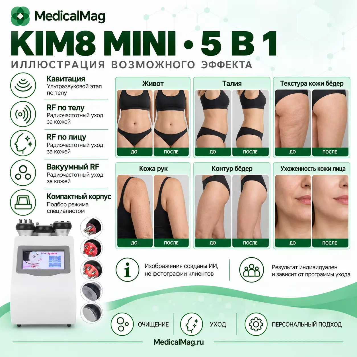 Аппарат Kim 8 MINI (5 в 1 кавитация, RF, вакуум)