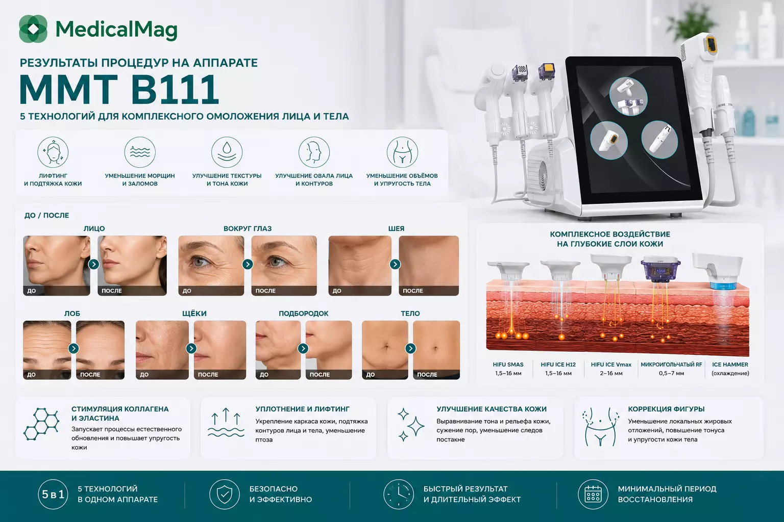 Аппарат микроигольчатого RF и HIFU SMAS лифтинга 5в1 MMT B111