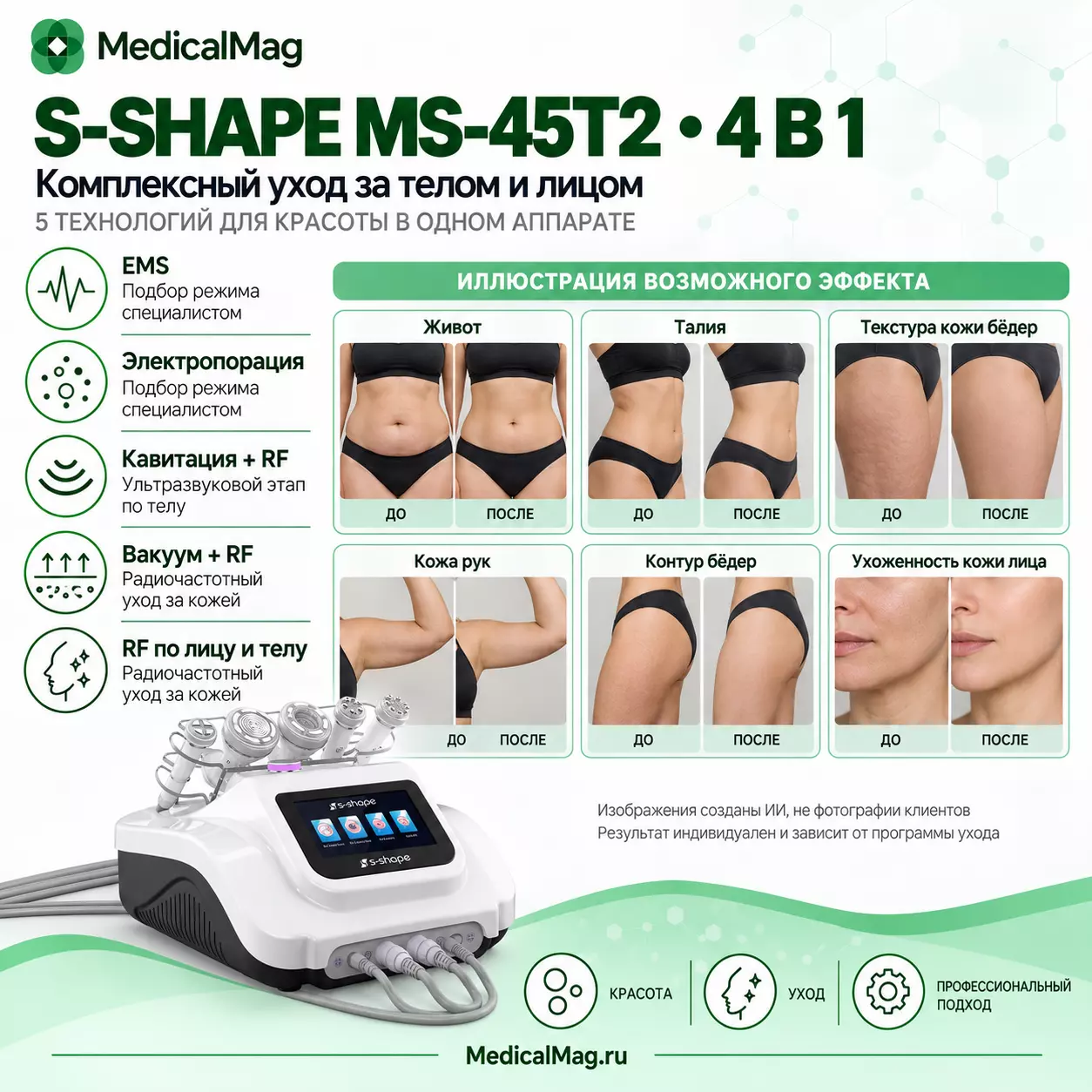 Аппарат 4 в 1 S-SHAPE: EMS + электропорация по лицу; кавитация + RF; вакуум + RF; RF-лифтинг лица и тела MS-45T2