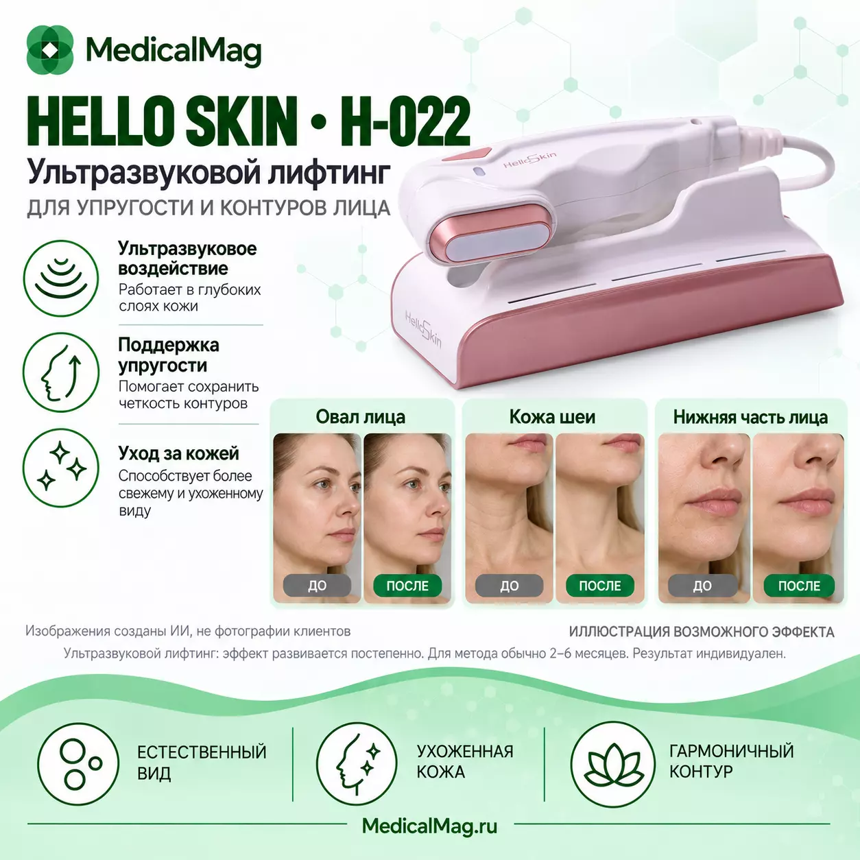 Аппарат HIFU Hello Skin H-022