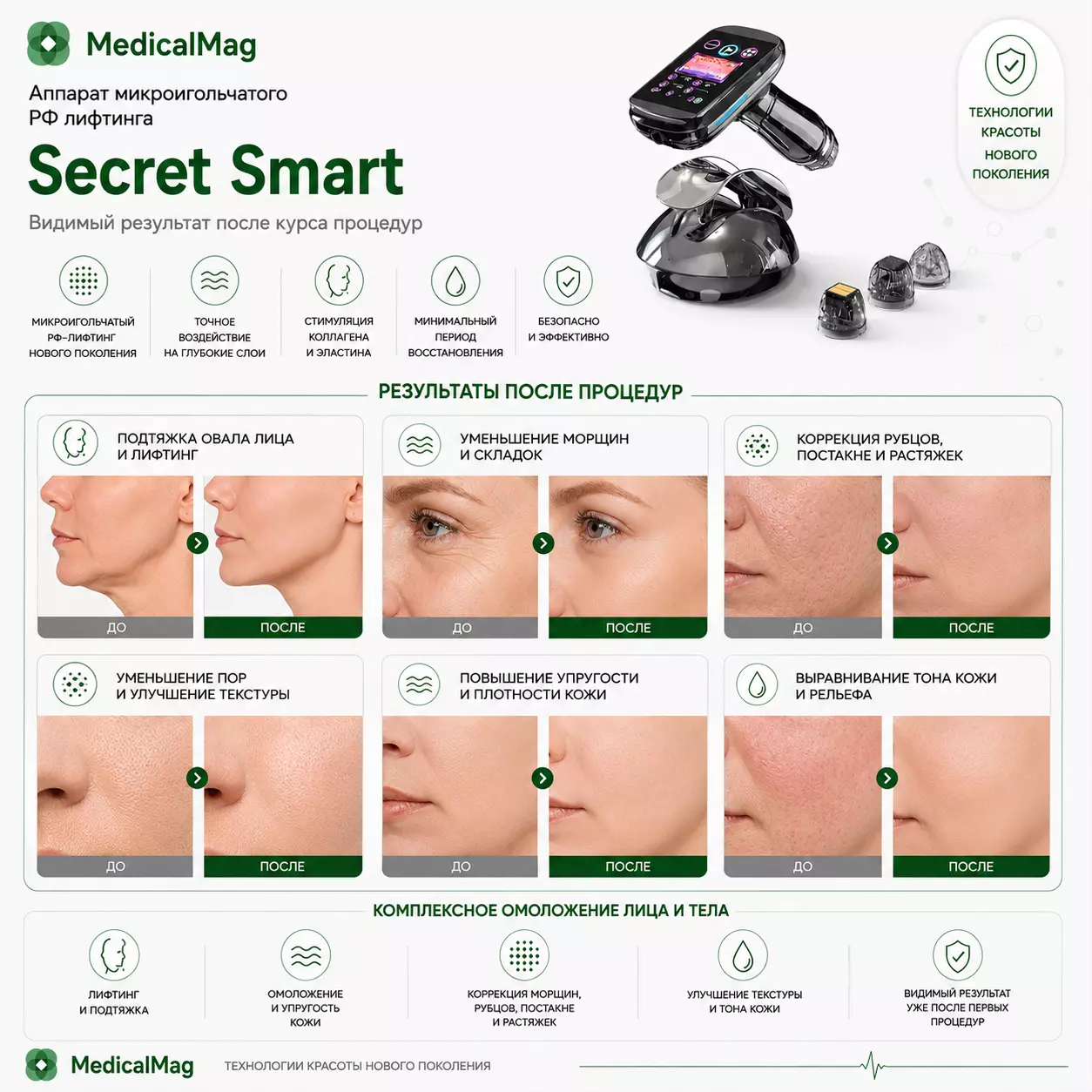Аппарат микроигольчатого РФ лифтинга Secret Smart