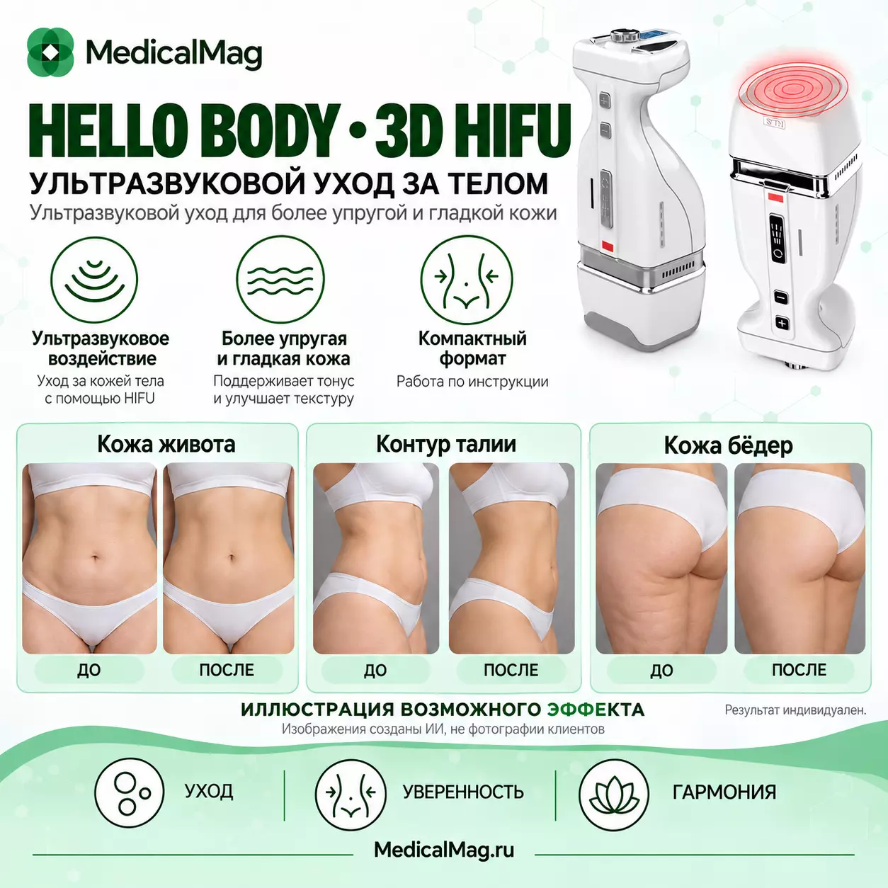 Аппарат коррекции жировых отложений и SMAS омоложения HELLO BODY 3D HIFU
