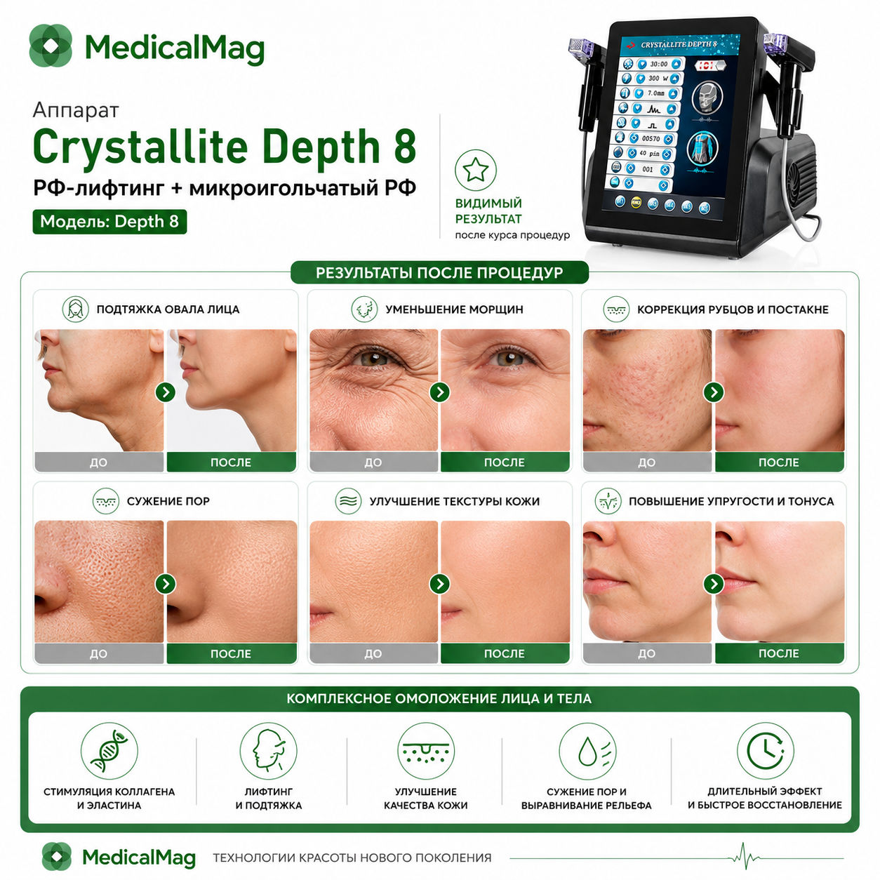 Аппарат Crystallite Depth 8 РФ-лифтинг + микроигольчатый РФ Модель: Depth 8
