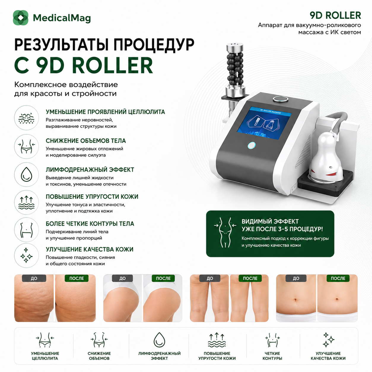 Аппарат для вакуумно-роликового массажа с ИК светом 9D Roller