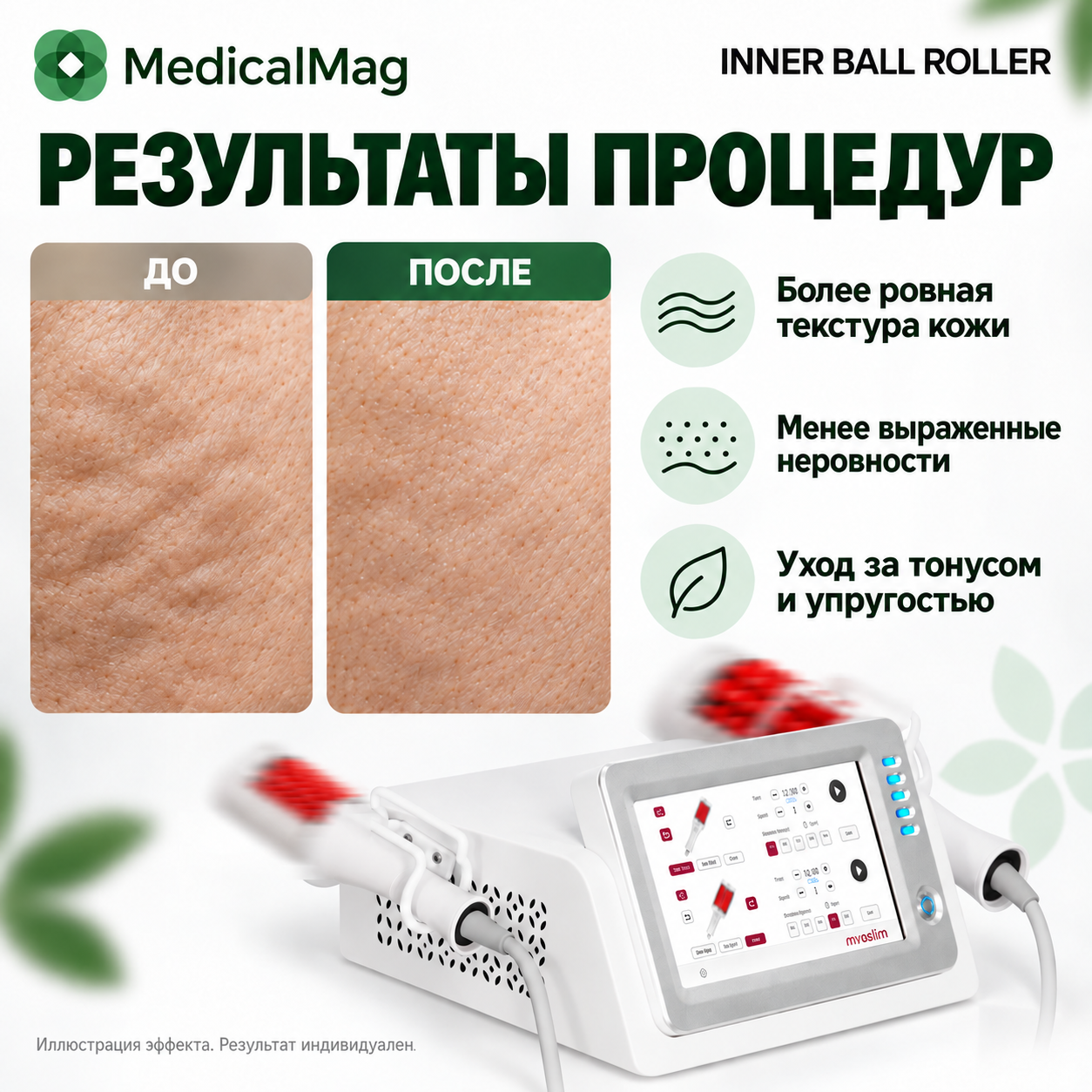 Аппарат виброкомпрессионного массажа Inner Ball Roller