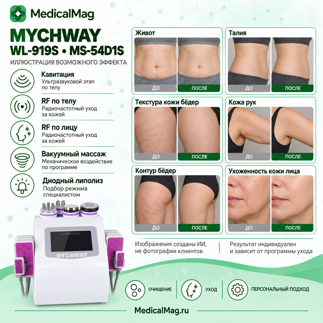 Косметический аппарат 7 в 1 Mychway WL-919s (MS-54D1S): Диодный липолиз + Кавитация + Радиолифтинг + Вакуум