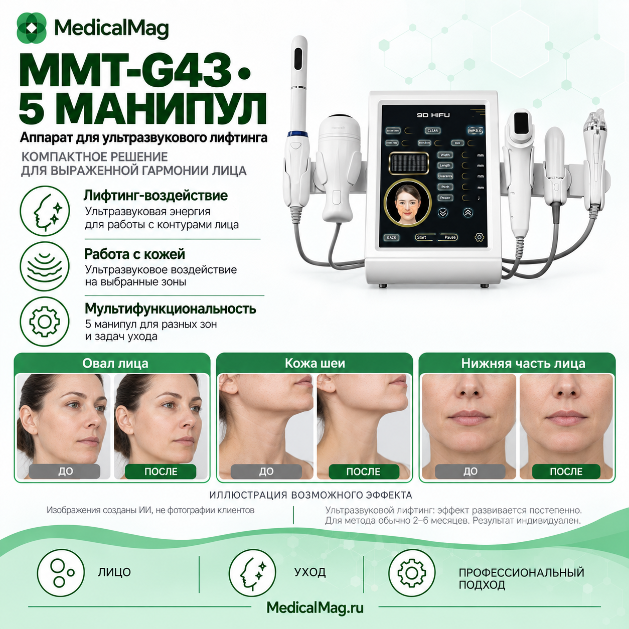 Аппарат СМАС лифтинга + RF + Интимное MMT-G43 (5 манипул)