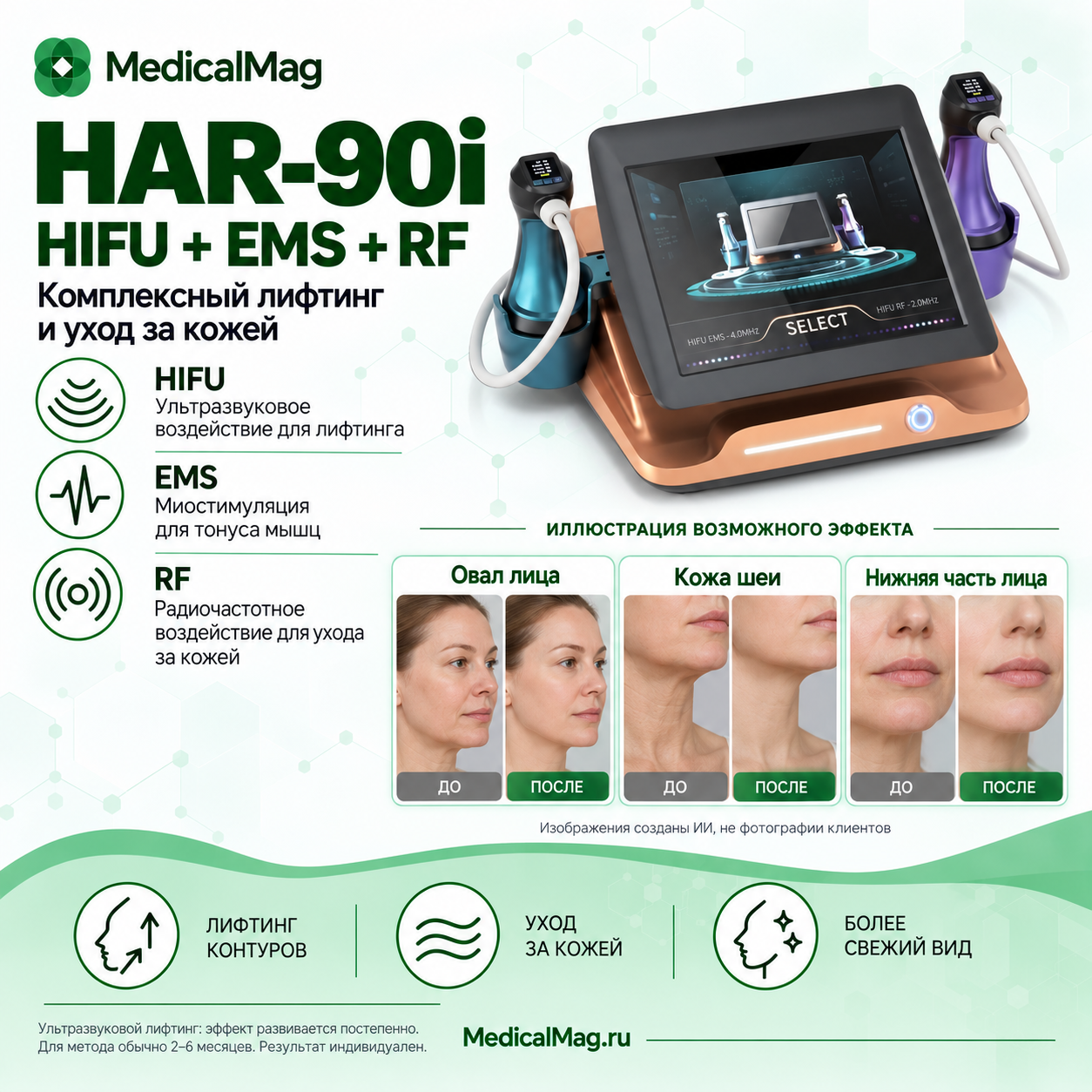 Аппарат SMAS лифтинга HIFU для омоложения и подтяжки кожи с EMS и RF (2 манипулы) HAR-90i