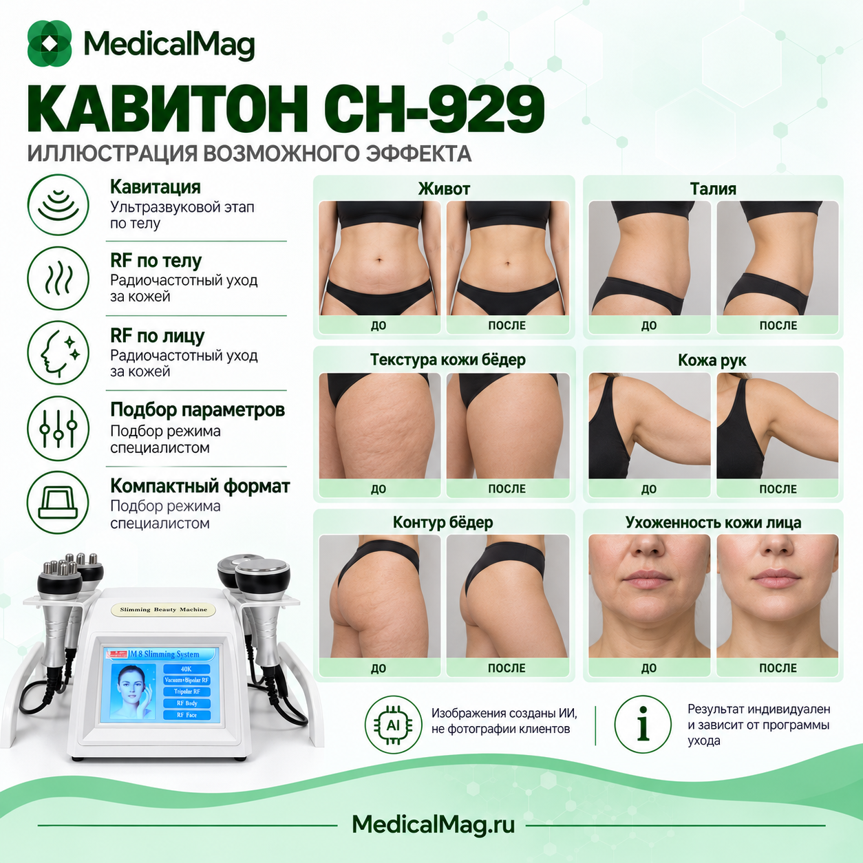 Многофункциональный косметический комбайн для лица и тела КАВИТОН СН-929