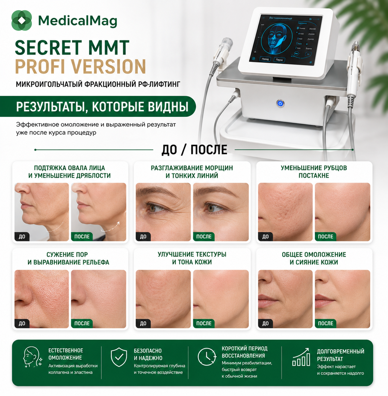 Аппарат микроигольчатого фракционного РФ лифтинга SECRET MMT PROFI VERSION