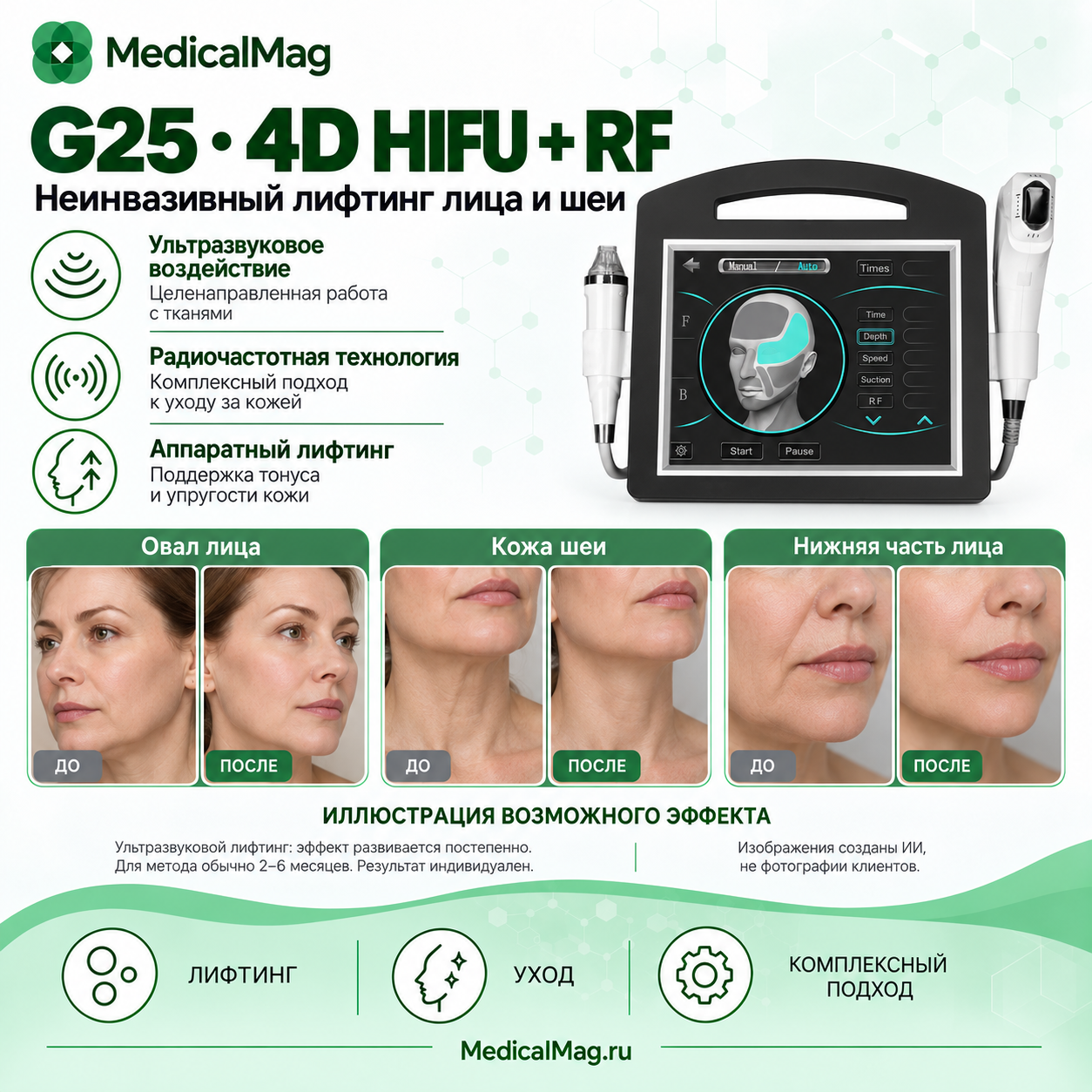 Аппарат G25: 4D HIFU SMAS + Микроигольчатый РФ