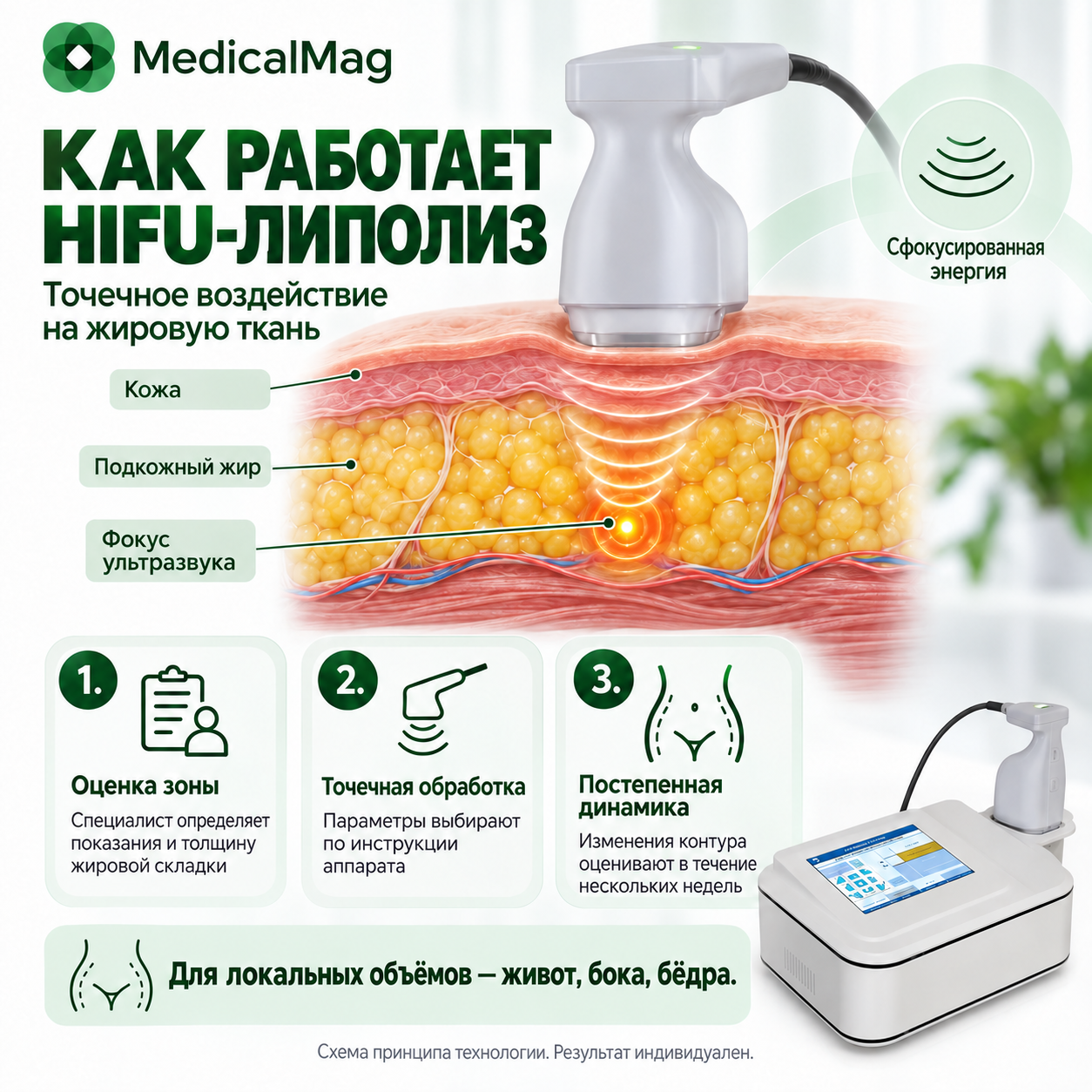 Liposonix (Липосоникс) портативный аппарат для похудения и коррекции фигуры SA-ULIPO-D