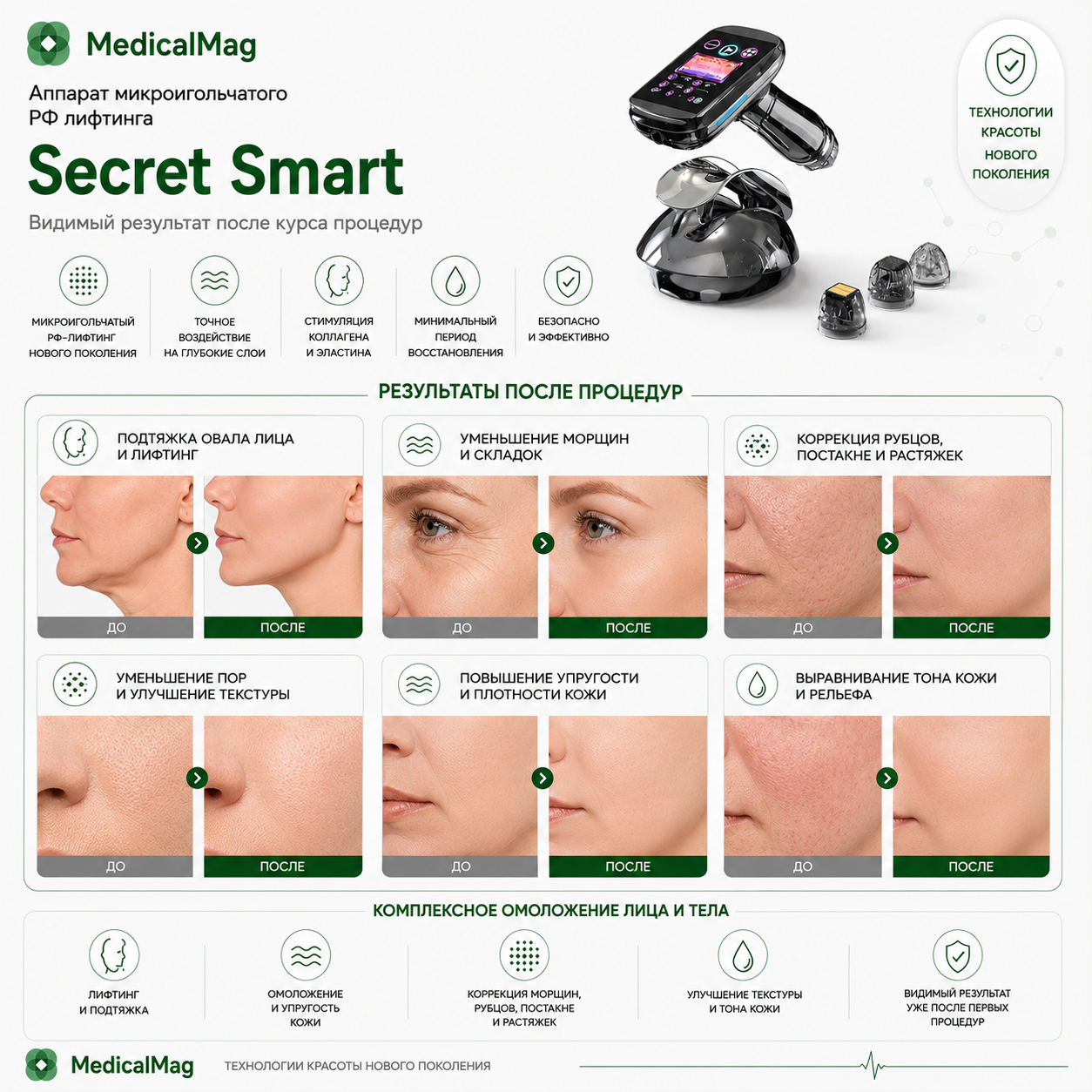 Аппарат микроигольчатого РФ лифтинга Secret Smart