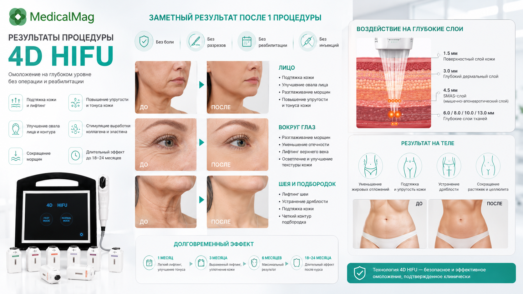 Аппарат для омоложения 4D HIFU (8 картриджей)